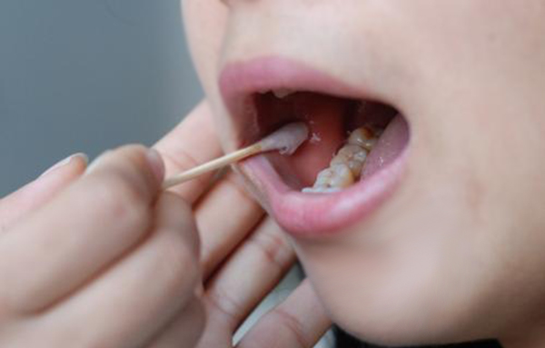 怀化上户DNA鉴定需要怎么做呢,